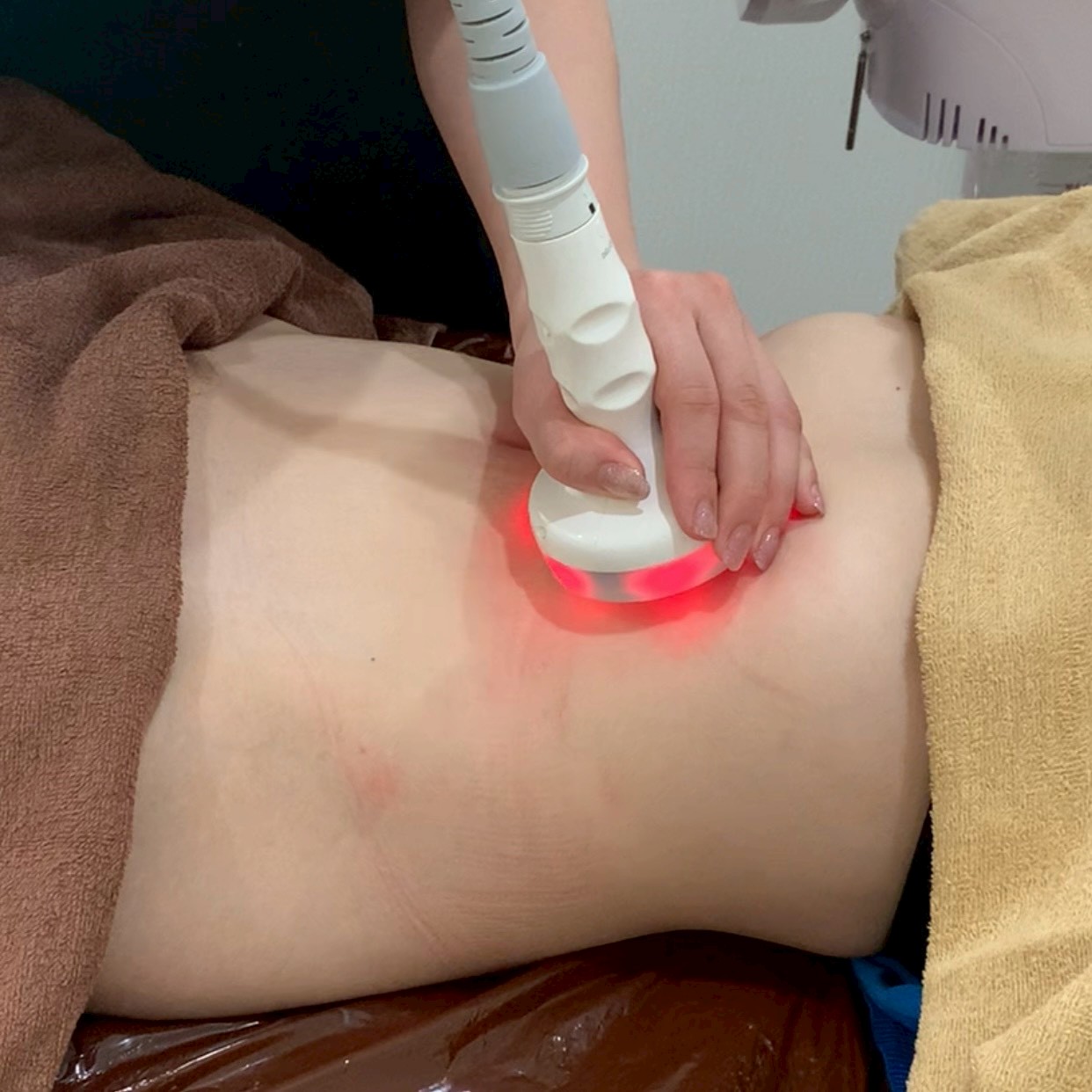 お腹まわりの痩身マシンケア