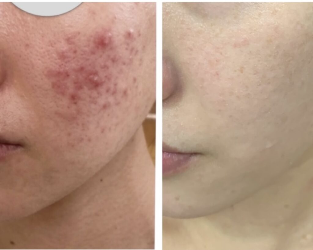 フェイシャルの施術事例 BEFORE / AFTER